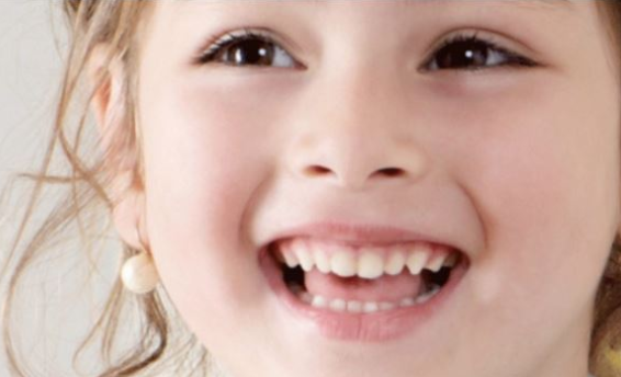 viêm tủy răng ở trẻ em, điều trị viêm tủy răng ở trẻ em, bệnh viêm tủy răng ở trẻ em, cách điều trị viêm tủy răng ở trẻ em, viêm tủy răng ở trẻ, viêm tủy răng ở trẻ nhỏ, Viêm tủy răng ở trẻ, trẻ bị viêm tủy răng, viêm tủy răng trẻ em, viêm tủy răng ở trẻ nhỏ, viêm tủy răng sữa ở trẻ, viêm tủy răng sữa, cách điều trị viêm tủy răng