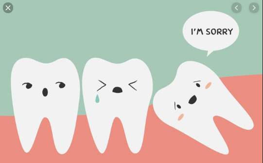 biến chứng nhổ răng khôn, biến chứng nhổ răng số 8, biến chứng nhổ răng, biến chứng nhổ răng khôn hàm trên, biến chứng sau nhổ răng, biến chứng sau nhổ răng khôn, biến chứng sau nhổ răng số 8, những biến chứng sau nhổ răng khôn, các biến chứng sau nhổ răng, biến chứng sau khi nhổ răng khôn, biến chứng sau khi nhổ răng số 8, những biến chứng sau khi nhổ răng khôn, những biến chứng sau khi nhổ răng