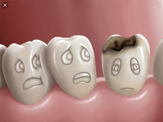 nhổ răng số 8 có nguy hiểm, nhổ răng số 8 có nguy hiểm k, nhổ răng số 8 có nguy hiểm ko, nhổ răng số 8 có nguy hiểm không, Nhổ răng số 8 chết người là có thật