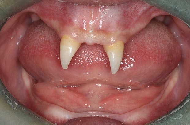 hàm răng xấu nhất thế giới, những hàm răng xấu nhất thế giới, người có hàm răng xấu nhất thế giới, hình ảnh hàm răng xấu, nụ cười xấu nhất thế giới 